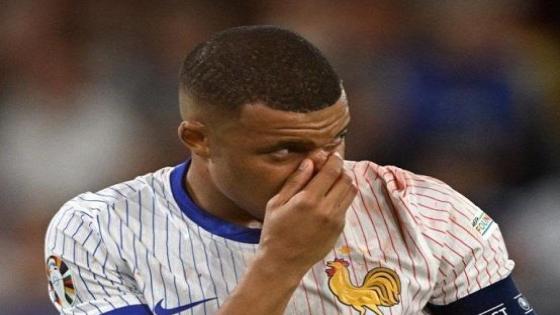 مبابي يصاب بكسر في أنفه في مباراة ضد النمسا