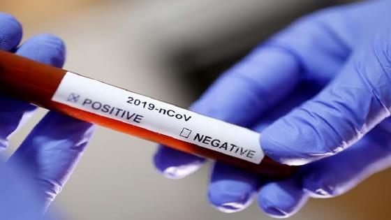 إسبانيا… تسجيل أكثر من 900 وفاة لليوم الثاني على التوالي بسبب فيروس "كوفيد 19"