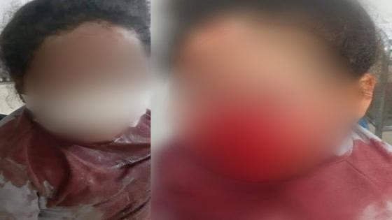 أمن طنجة تتفاعل مع صور منشورة على مواقع الفيسبوك تظهر طفلة تحمل جروحا على مستوى الوجه