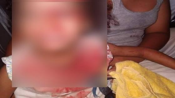 أمن الرباط يوقف عشريني اعتدى على طفلة بالضرب والجرح