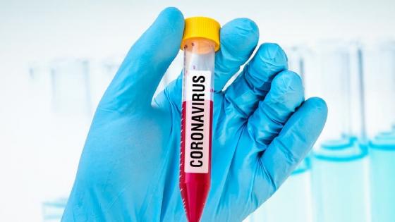 المغرب يسجل 520 حالة إصابة جديدة بفيروس كورونا و22 حالة وفاة خلال 24 ساعة