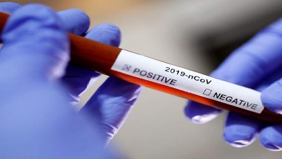 تسجيل 106 حالة إصابة جديدة بفيروس "كورونا" بالمغرب خلال الـ 16 ساعة الماضية