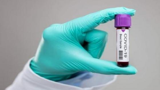 موريتانيا… تسجيل 99 حالة إصابة جديدة مؤكدة بفيروس كورونا خلال 24 ساعة