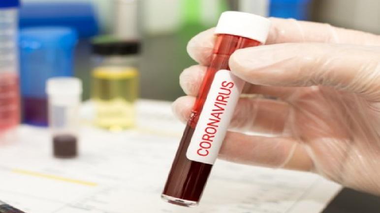 وزارة الصحة تنفي ما نشرته إحدى الجرائد بخصوص كلفة اقتناء اختبارات الكشف عن فيروس كورونا