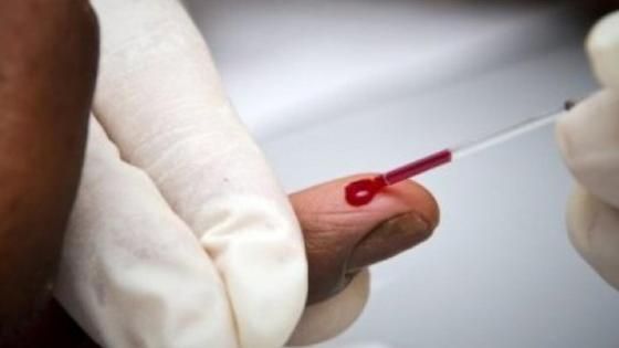 جنوب إفريقيا.. أزيد من 8 ملايين شخص يتعايشون مع فيروس (السيدا)